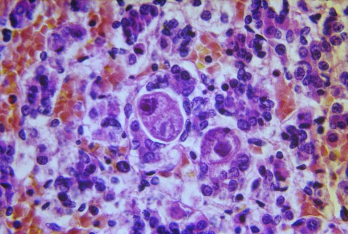 Microscopic image of cytomegalovirus (CMV)?